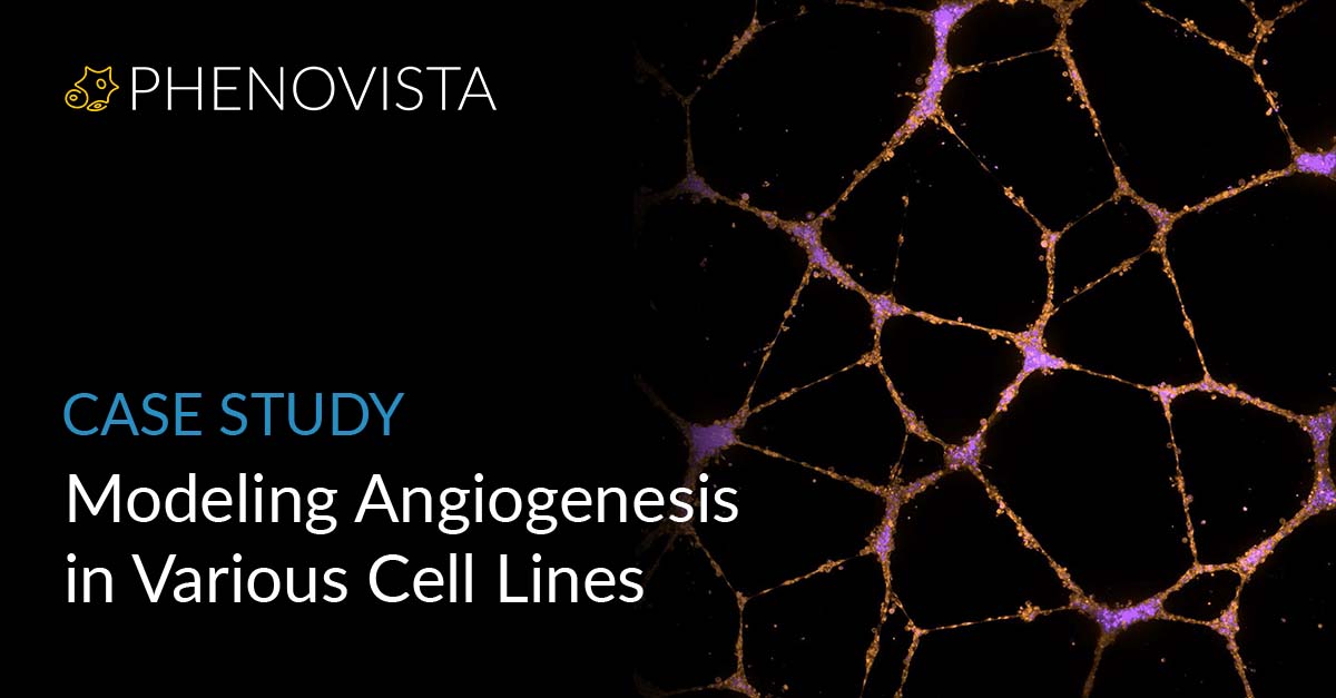 angiogenesis-in-cell-lines-thumbnail-1200x627